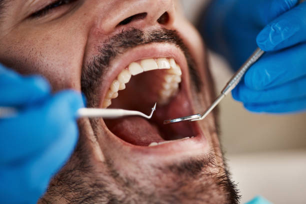 Professional Emergency Dental Service in MO